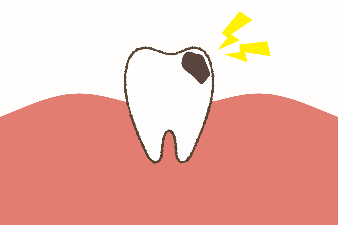 子どもがむし歯になりやすい原因って？