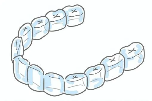 インビザラインマウスピースのイラスト