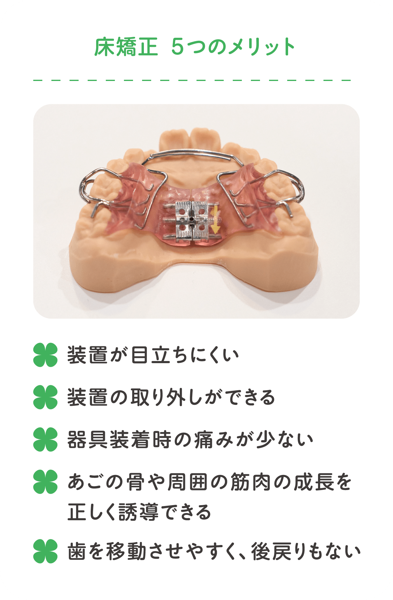 床矯正 ５つのメリット