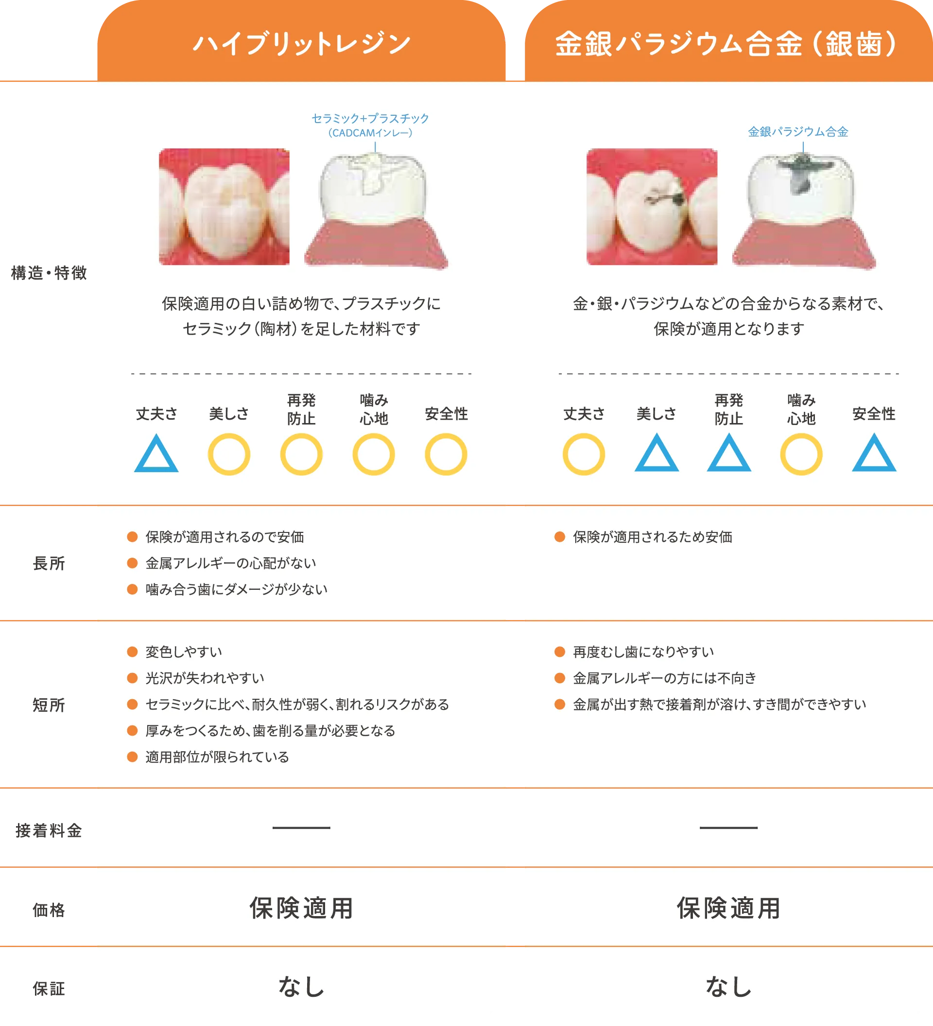 詰め物(インレー)エコノミー比較表