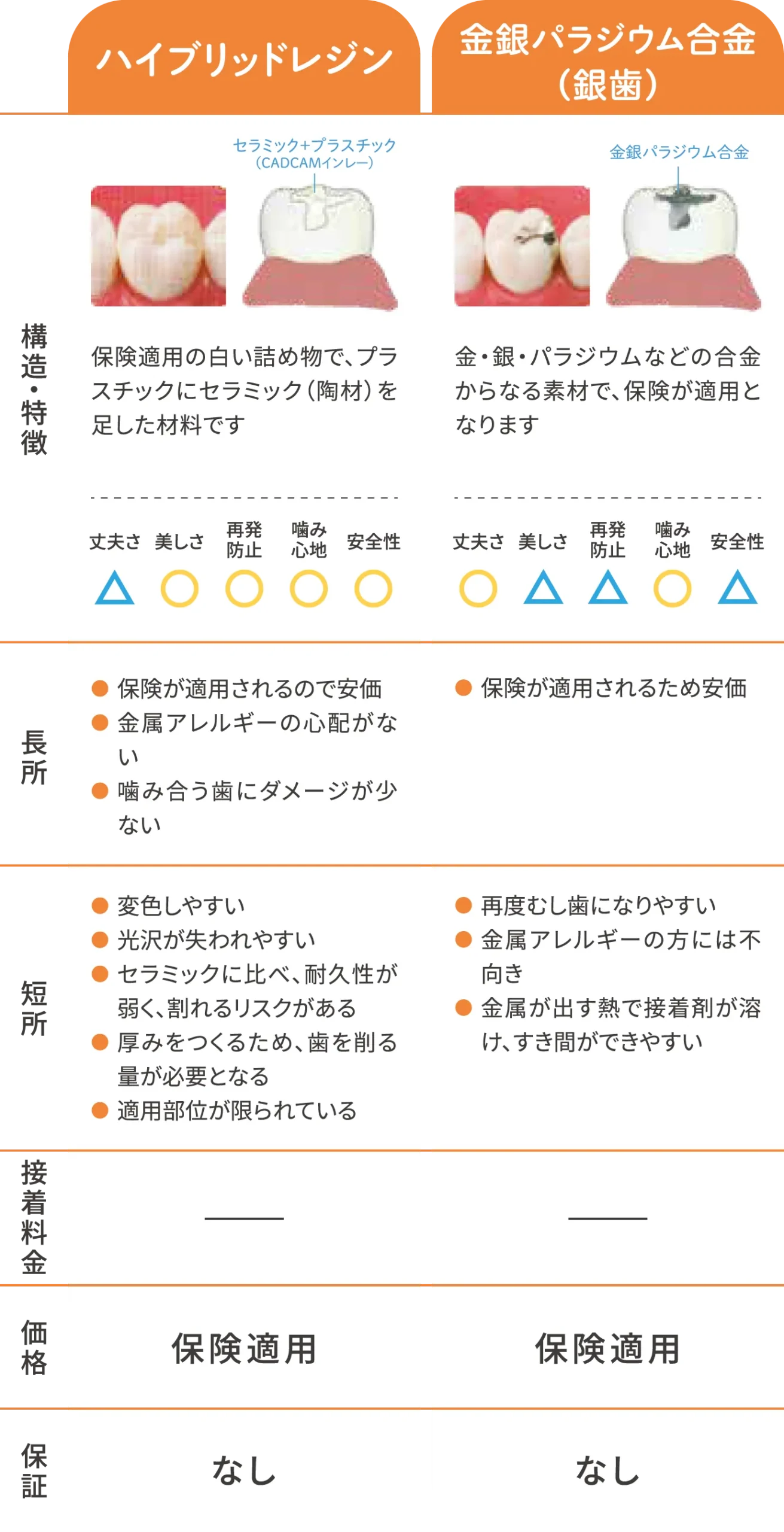 詰め物(インレー)エコノミー比較表