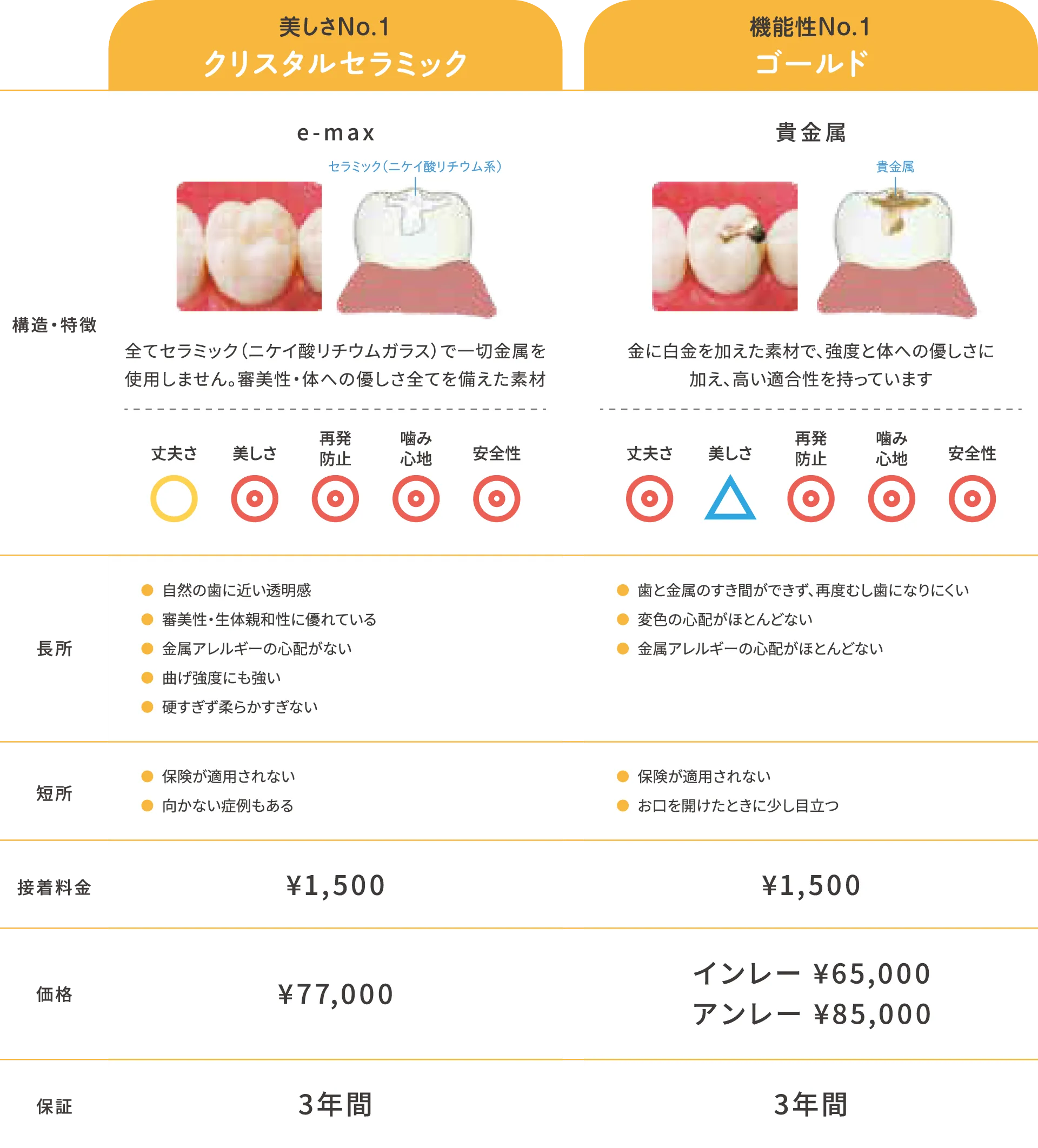 詰め物(インレー)ハイグレード比較表