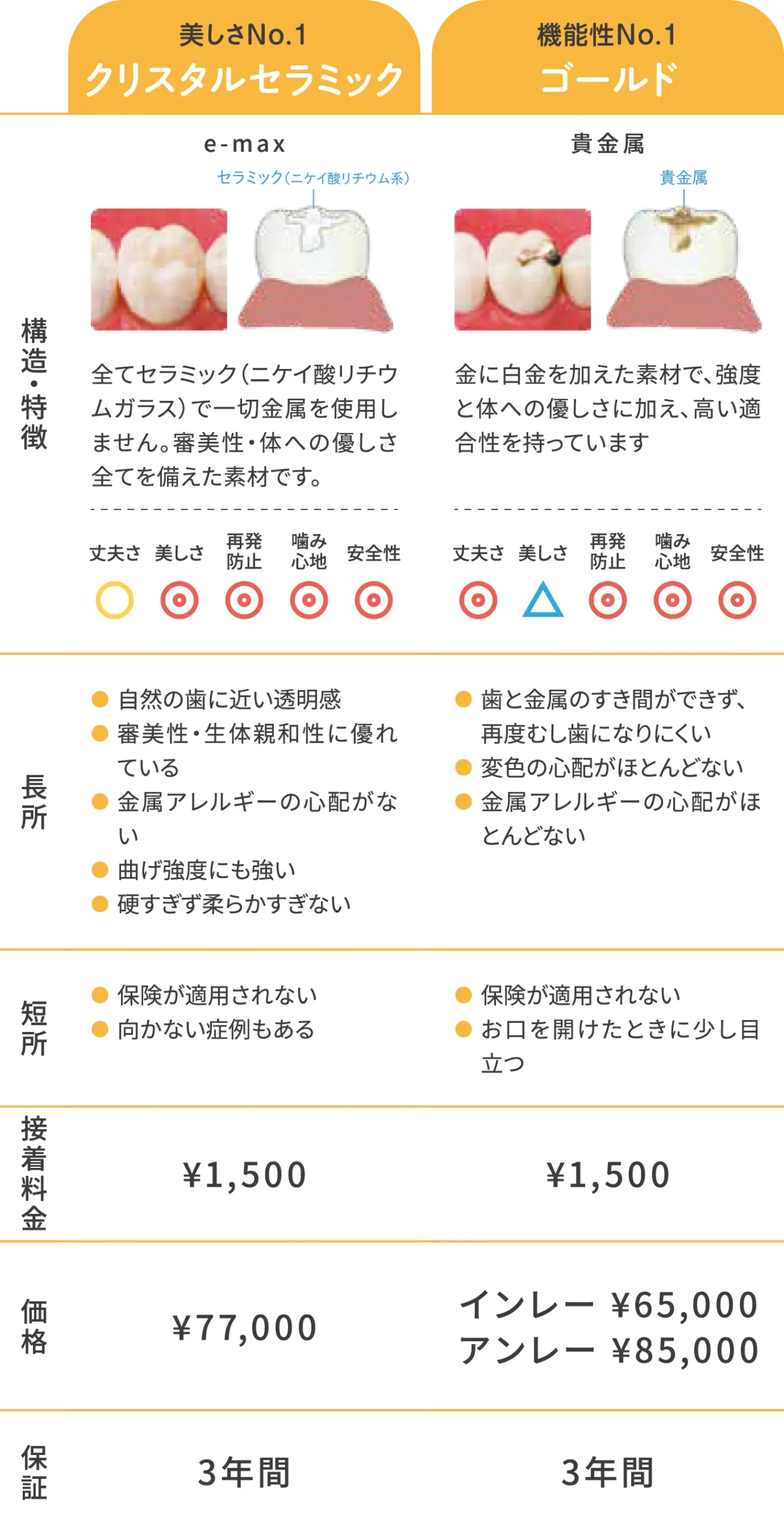 詰め物(インレー)ハイグレード比較表