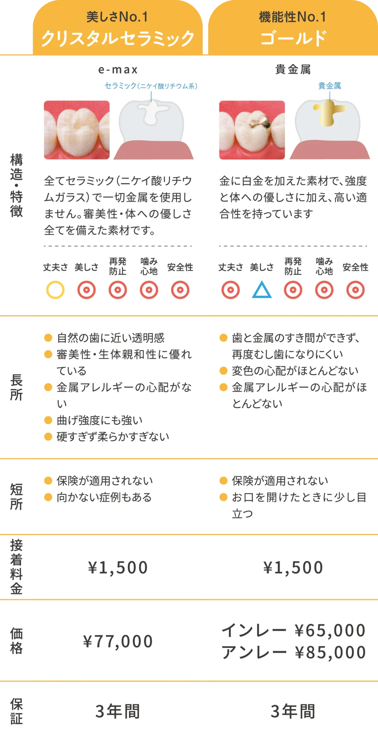 詰め物(インレー)ハイグレード素材詳細