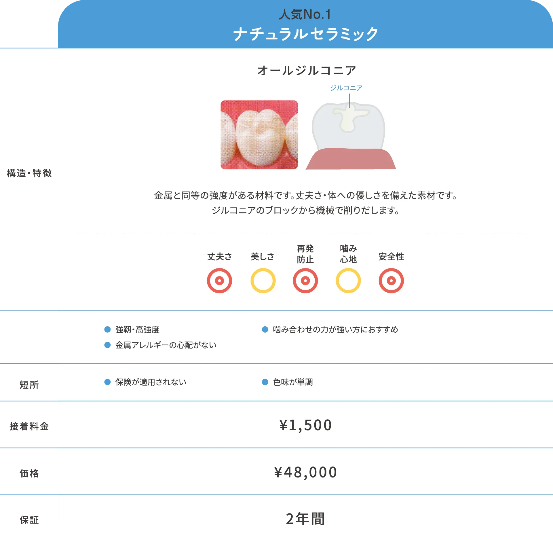 詰め物(インレー)スタンダード素材詳細