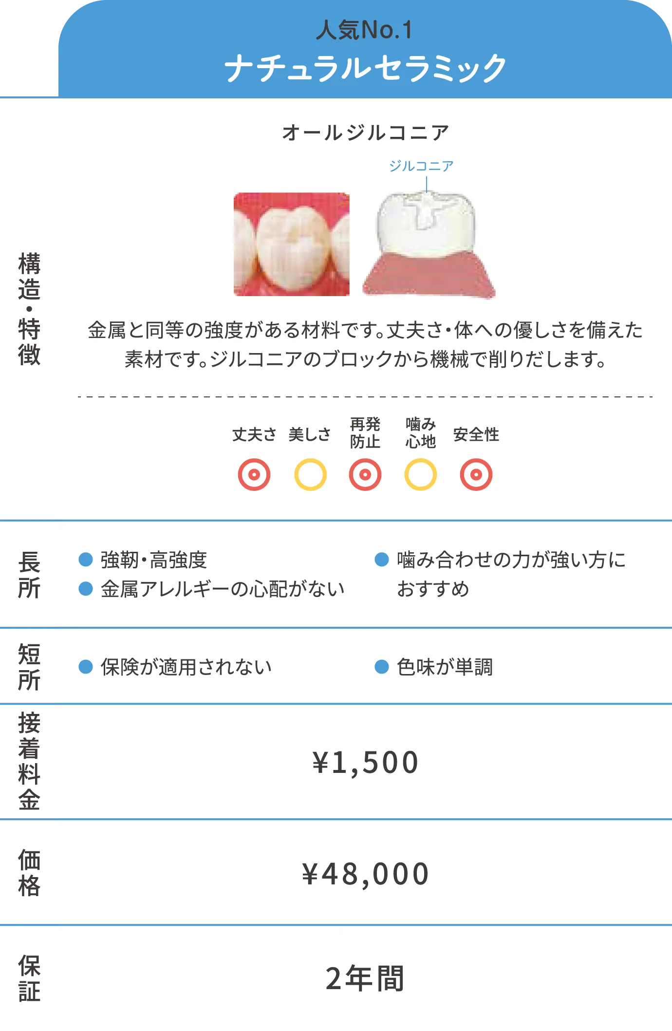 詰め物(インレー)スタンダード詳細
